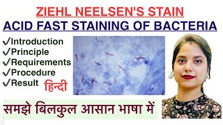 ZN stain in Hindi  Acid Fast staining of Bacteria  Microbiology  MLT [upl. by Noel]