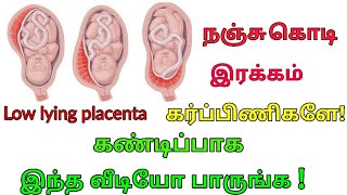 நஞ்சு கொடி இரக்கம்  Nanju Kodi Irakkam in Tamil  Placenta Position During Pregnancy [upl. by Annovad]