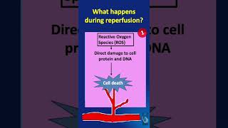 Shorts  119 IschemiaReperfusion Injury IRI  What happens during the reperfusion phase [upl. by Philipa]