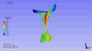 Finite element model of a mitral valve [upl. by Urata]