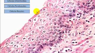 Histopatología  Tejido Epitelial II [upl. by Barbabra]