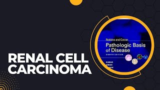 Renal cell carcinoma  Risk factors  Pathogenesis  Morphology  Clinical features [upl. by Adav]