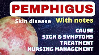 Pemphigus in hindi  cause symptoms treatment nursing management  pemphigus skin problem  msn [upl. by Semreh]