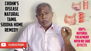 Crohns disease treatment in tamil  Best natural home remedy for crohns disease  Marunthu Venduma [upl. by Swane]