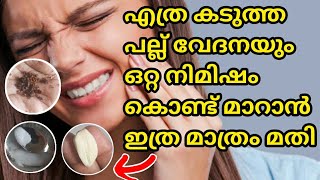 Instant toothache pain reliefTooth pain Solution💯 Resultപല്ല് വേദന മാറാൻtooth pain home remedy [upl. by Cnut79]