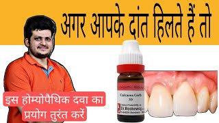 अगर आपके दांत हिलते हैं तो  How can I strengthen weak teeth  Homeopathic Medicine  Use [upl. by Occir594]