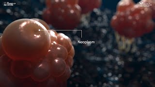 Neoplasm  3D Animation [upl. by Norine]