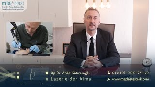 Lazerle Ben Alma  Op Dr Arda Katırcıoğlu [upl. by Idram504]