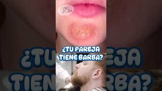 Cuida tu BARBA o causarás ESTO ✌🏻 más en IG medicina sabiasque curiosidades [upl. by Nadbus]