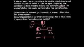 Ptosis  Dominant genetic disorder problem and solution [upl. by Apicella]