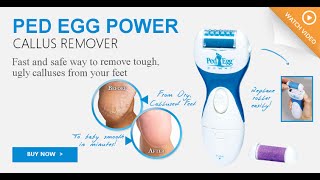 JML Ped Egg Power [upl. by Nynahs]