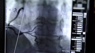 A Stent in Time Saves Lives [upl. by Korey247]