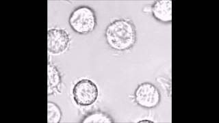 Mast cells mediate malignant pleural effusion formation [upl. by Silvio]