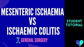 Mesenteric Ischaemia vs Ischaemic Colitis  Medical Tutorial [upl. by Kleinstein]