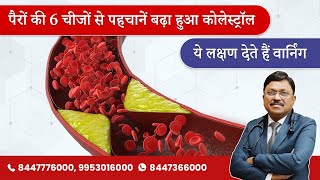 पैरों की 6 चीजों से पहचानें बढ़ा हुआ कोलेस्ट्रॉल  High Cholesterol  Symptoms amp Causes  SAAOL [upl. by Ramonda]