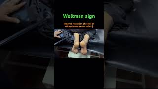 Woltman sign  hypothyroidismdelayed relaxation phase of an elicited DTR  clinical neurology [upl. by Hgielanna]