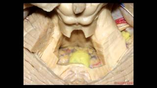 Cerebellopontine Angle and Fourth Ventricle  Part 1 of 2 [upl. by Stevenson832]