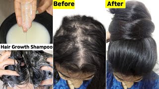 I used this👆🏼Hair Growth Shampoo on ScalpTo Get Thick Dense Hair GrowthStop Hairfall amp Hair Loss [upl. by Austin]