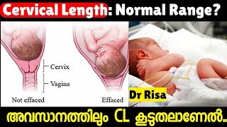 നേരത്തെയുള്ള പ്രസവ സാധ്യതക്ക് കാരണമാകുന്ന CERVICAL LENGTH 9 month Pregnancy [upl. by Laurence]