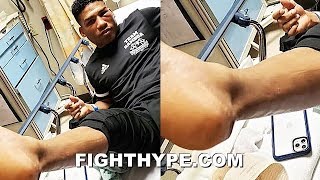 GAMBOA SETS RECORD STRAIGHT ON FIGHTING GERVONTA DAVIS WITH quotSNAPPEDquot TENDON quotI REFUSED TO QUITquot [upl. by Laris734]