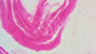 Tinea versicolor under the microscope with Haematoxylin and Eosin HampE stain [upl. by Nnairek243]