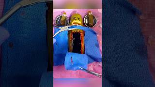 Pickle TWINS 😰Mom Flatlines During Emergency FruitSurgery Csection FoodSurgery DiscountDentist [upl. by Mungo]