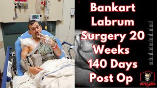 Bankart Labrum Surgery 20 weeks 140 days Post Op [upl. by Fleda]