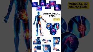 Orthopedic Reel medical animation 3d short BiologywithAliya [upl. by Spiegel]