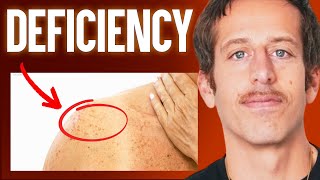 The 1 Deficiency Behind Aging Spot amp Treat This ASAP  Ben Azadi [upl. by Marguerite410]