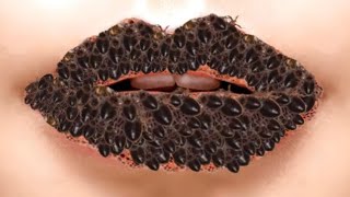 ASMR treatment leech removal from lips 👄 ASMR lips animation infected  ASMR bug asmr tending video [upl. by Bloomer]