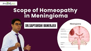 Brain Tumor Meningioma  Types Risk Factors Symptoms and Treatment with Homeopathy [upl. by Learsiy]