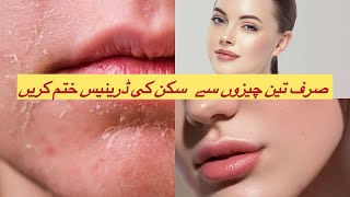 DryDark Skin Remedy  Simple Home Remedies For Dry Skin  Get Glowing Hydrated Skin This Winter [upl. by Valerie]