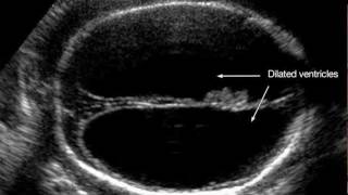 Ultrasound Training Assessment of Fetal Growth and HighRisk Pregnancies [upl. by Terese]