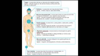 Traitements Naturel Des Mycoses [upl. by Ahcire84]