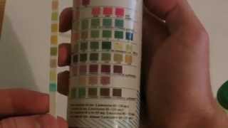 How to perform Urinalysis [upl. by Nosnar473]