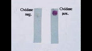 Oxidase Test [upl. by Derrick]