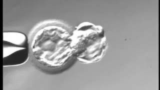 Day 5 full hatched blastocyst under microscope [upl. by Enibas]