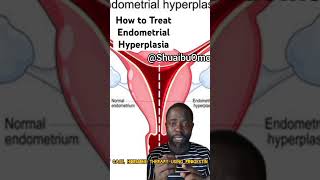 How to Treat Endometrial Hyperplasia cancerawareness bodysystem [upl. by Nawad]