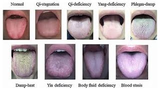 TONGUE COATING COLOR [upl. by Dutchman]