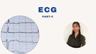 ECG PART5 the coronary circulation [upl. by Fraze]