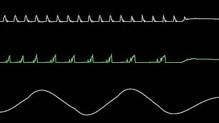 COMMODORE C64 SID  2019  VOODOO PEOPLE TRIBUTE  JAMMER KAMIL WOLNIKOWSKI  Oscilloscope View [upl. by Vivia578]