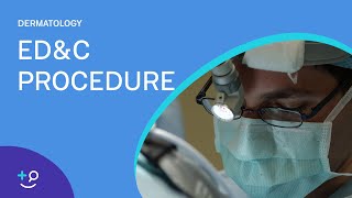 EDampC Procedure Overview Dermatology [upl. by Orlene654]