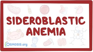 Sideroblastic anemia  causes symptoms diagnosis treatment pathology [upl. by Willyt]