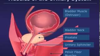 Botox Injections for Bladder Conditions [upl. by Nishom9]