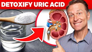 The Ultimate Kidney Cleanse for Uric Acid and Gout Dr Bergs Proven Techniques [upl. by Sansen]