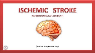 Stroke Part 1  Ischemic Stroke  Types  Causes  Pathophysiology  Treatment  The Nurses Station [upl. by Noram]