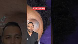 Huge cyst removal 😱 [upl. by Efar]