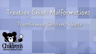 Chiari Malformations What Parents Should Know  Childrens National [upl. by Netsoj]