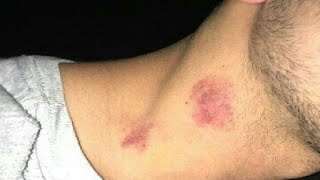 how to give someone a hickey on the neck for the first time [upl. by Cost]