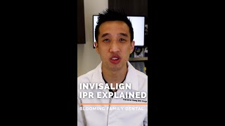 Invisalign IPR Explained [upl. by Natie314]